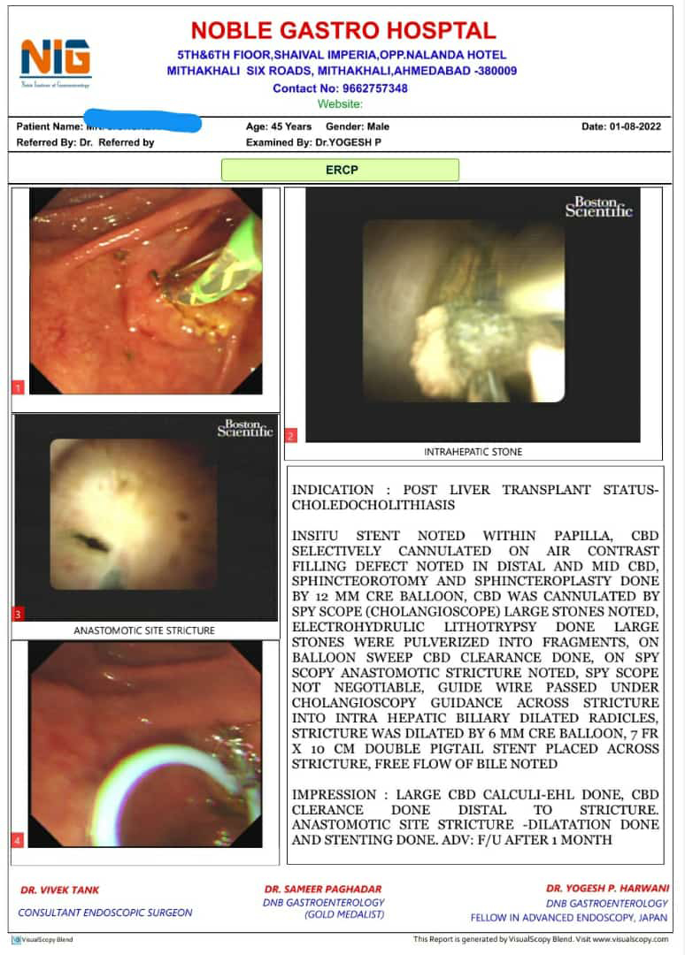 Difficult and intersting case of cholangioscopy