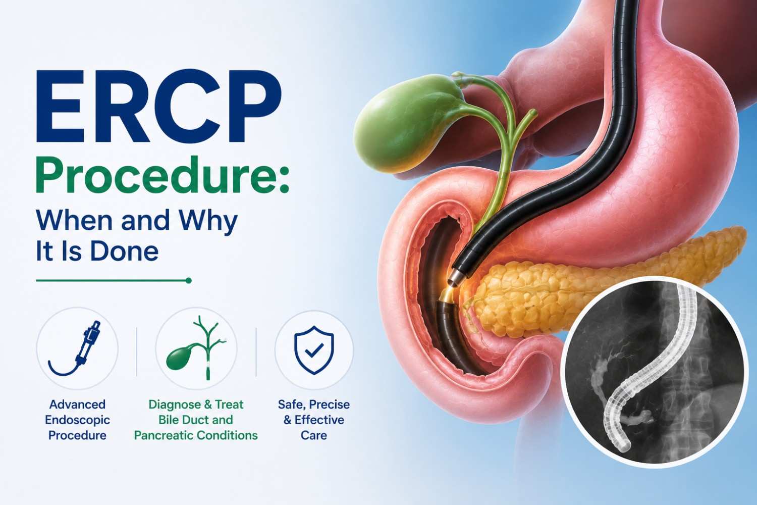 ERCP Procedure