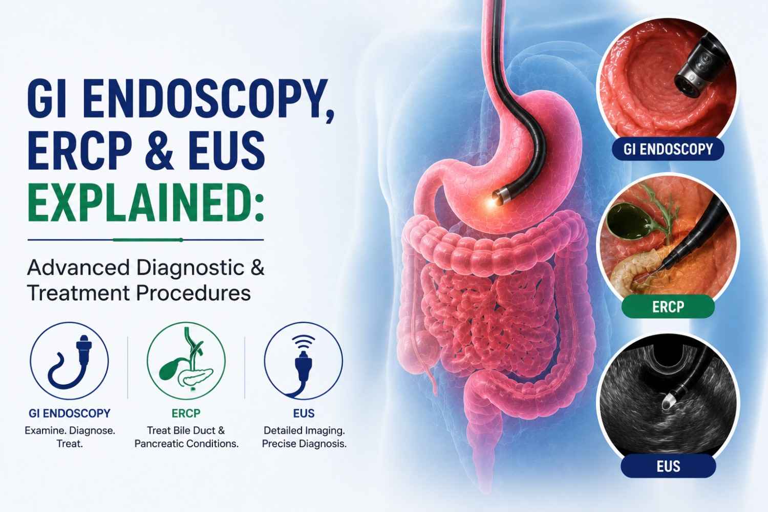 GI Endoscopy ERCP EUS